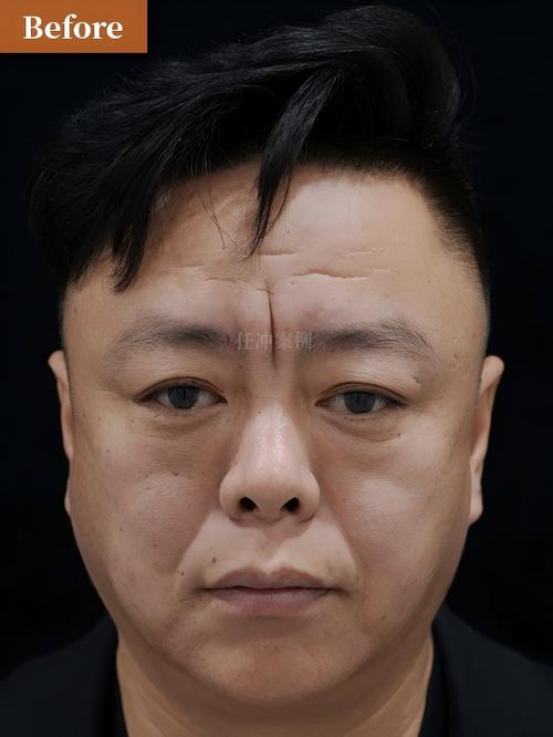 平保24小时在线套医保微信能用吗怎么弄？官方解答来了